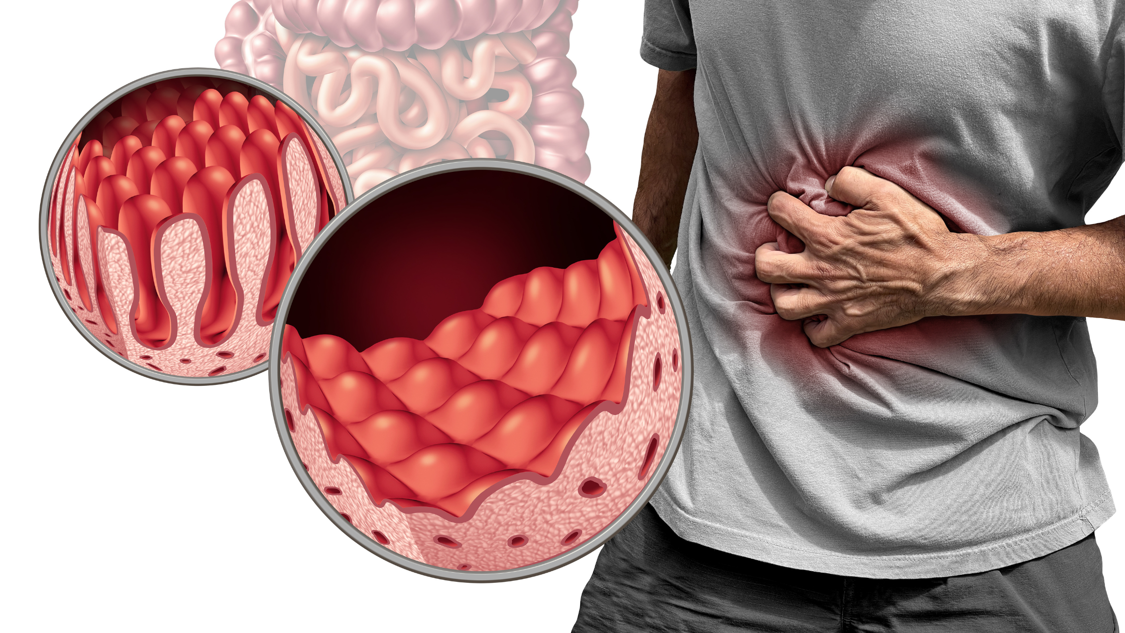 Can Low Stomach Acid and Enzyme Deficiency Affect Nutrient Absorption? 